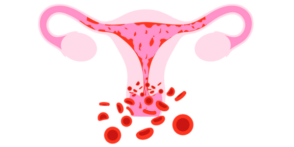 Abnormal uterine bleeding treatment at Sattva Fertility Care Center