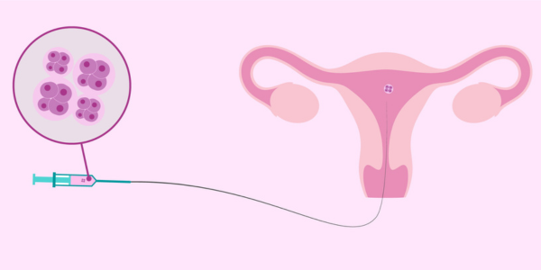 Embryo donation program at Sattva Fertility Care Center