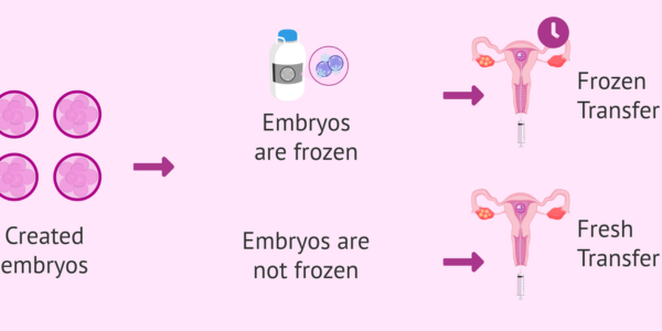 Embryo transfer procedure at Sattva Fertility Care Center
