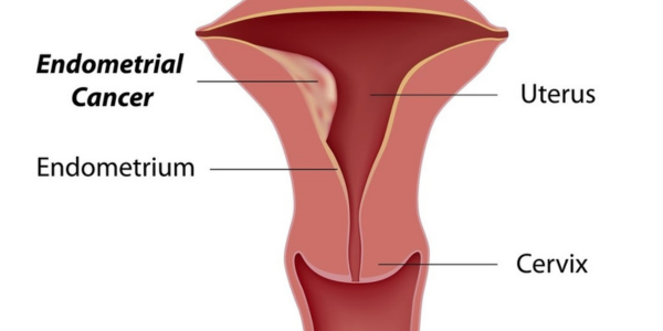 Endometrial sampling procedure at Sattva Fertility Care Center