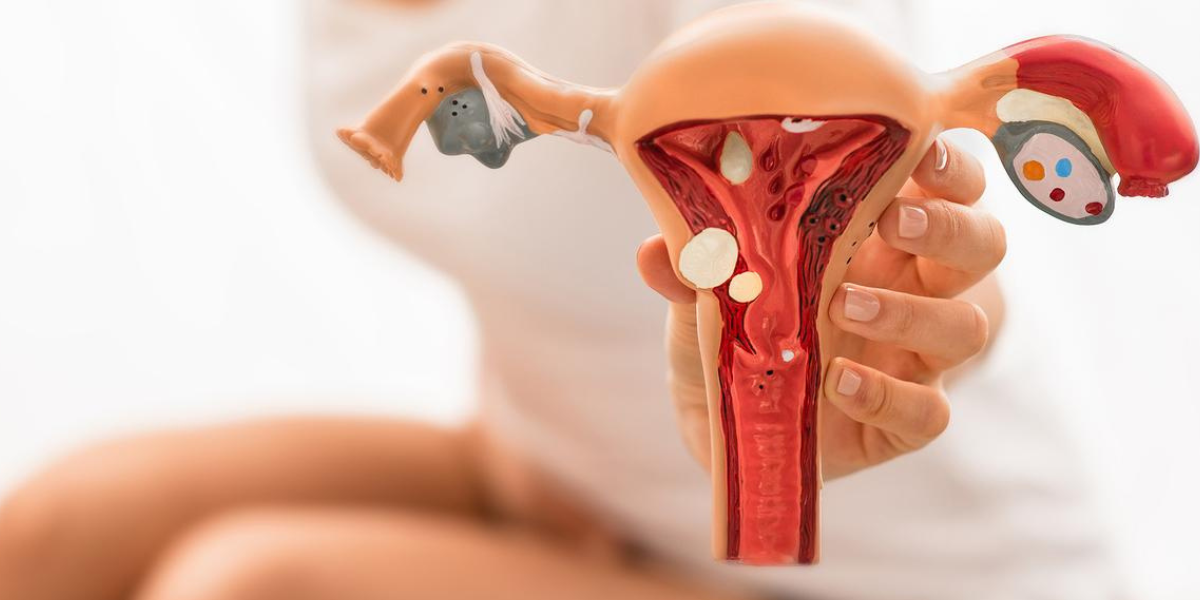 Endometriosis diagnosis and treatment consultation at Sattva Fertility Care Center