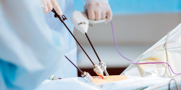 Laparoscopy surgery consultation at Sattva Fertility Care Center