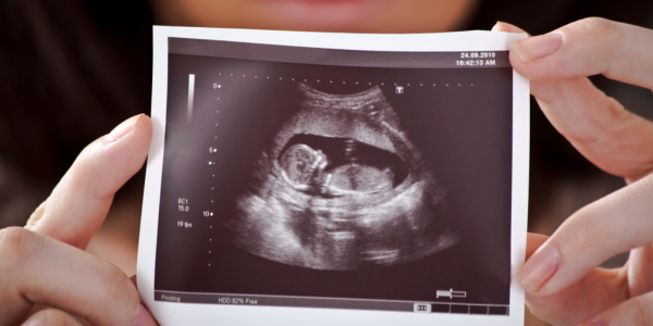 Real-time imaging ultrasonography at Sattva Fertility Care Center