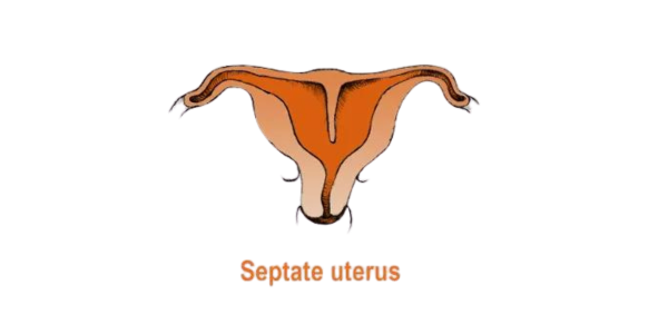 Recurrent miscarriages treatment at Sattva Fertility Care Center