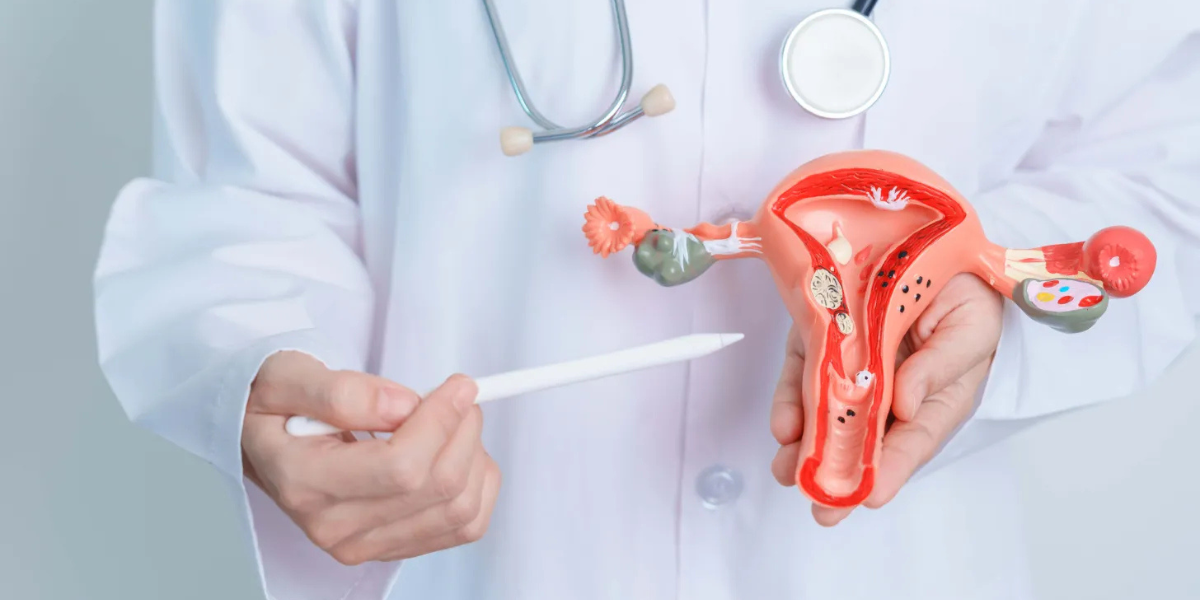PCOS infertility assessment consultation at Sattva Fertility Care Center